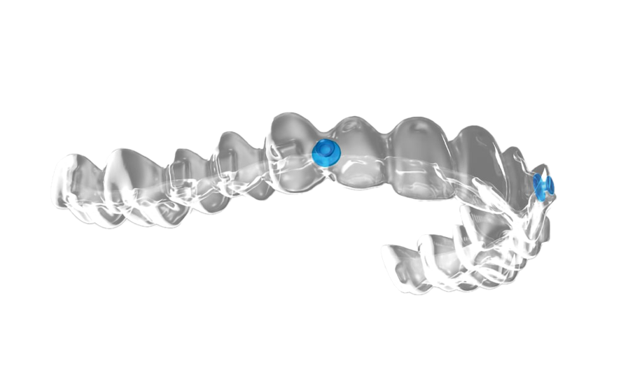 Invisalign